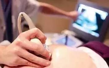 医院怎么检察怀孕？科普│这3项检查就能确定是否怀孕！
