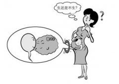 【提问】带环怀孕孩子能要吗？建议要从这2点考虑..