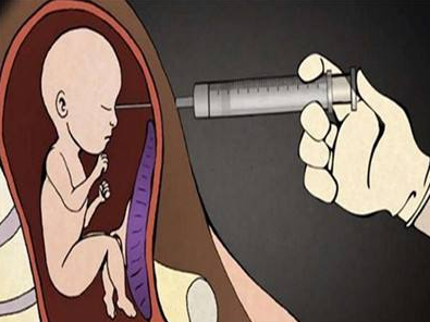怀孕90天可以做人流吗？淮安仁爱医生这样说